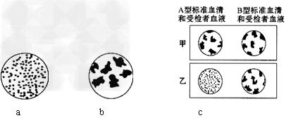 在显微镜下观察,如果红细胞呈游离状态,则无凝集现象