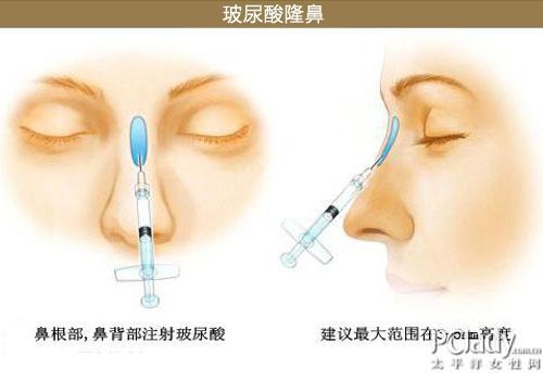 韩国签证新政策 5K赴韩微整形攻略 - 百科教程