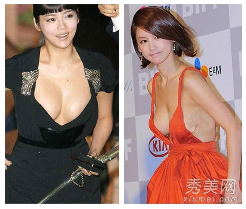 韩国<em>女星</em>红毯着装大胆 礼服滑落<em>小儿</em>科 - 百科