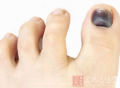 脚指甲变黑变厚危害