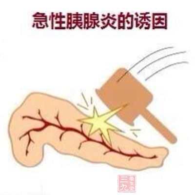 胰腺炎反复“发作”原来是心病在作祟 - 百科教程网_经验分享平台[上学吧经验教程频道]