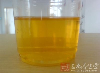 <em>小便</em>很<em>黄</em>是怎么回事_尿黄是什么原因引起的_