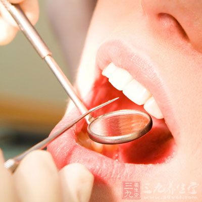 牙龈炎症状图片_牙龈炎怎么办