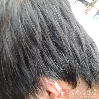 为什么会长白头发 长白头发的原因及预防 - 百科教程网_经验分享平台[上学吧经验教程频道]