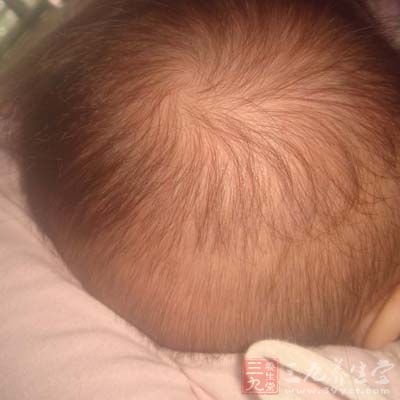 宝宝头发稀少怎么办 有什么方法解决 - 百科教