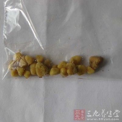 肾结石吃什么 这些食疗方法治愈肾结石 - 百科