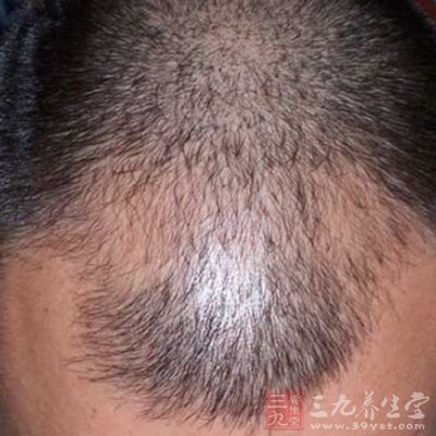 女人这里掉毛竟是它惹的祸 - 百科教程网_经验