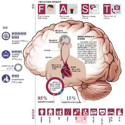 专家表示,作为脑卒中的独立危险