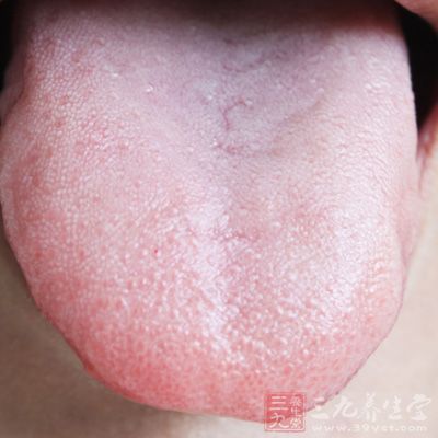 上火怎么办 如何灭掉体内那把火