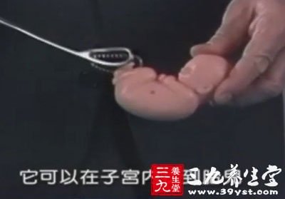 由于反复地钳刮子宫内膜,使子宫壁变
